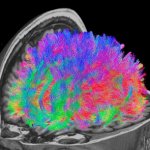 Multicoloured image of brain showing functional connectivity