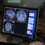 Three brain scan images
