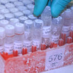 Tissue samples in the Wesley Research Institute biobank