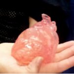 3D model of 1 year old's heart use to plan cardiac surgery