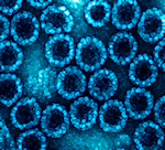 Electron micrograph of recombinantly produced virus-like particles